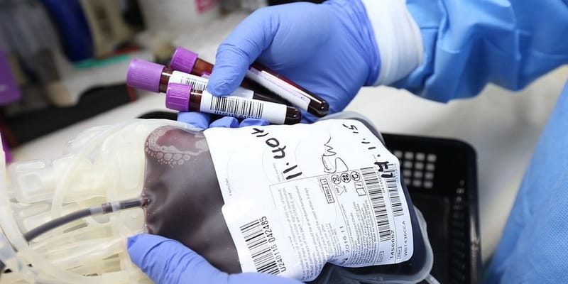 Krvná skupina A má najväčší vplyv na riziko mŕtvice